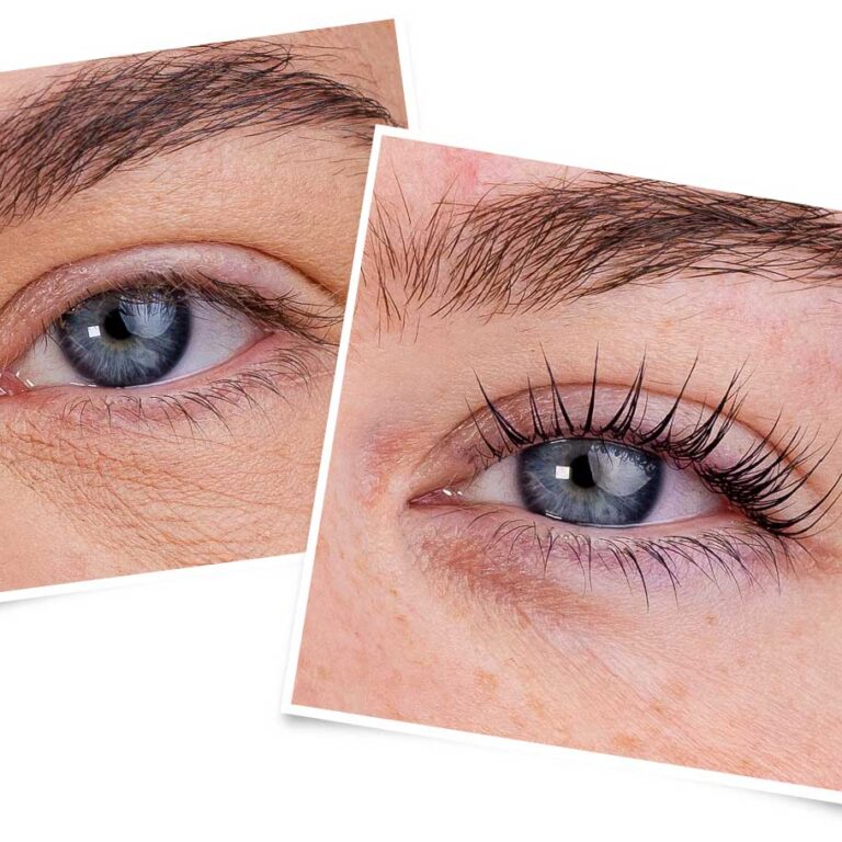 lvl_before_after